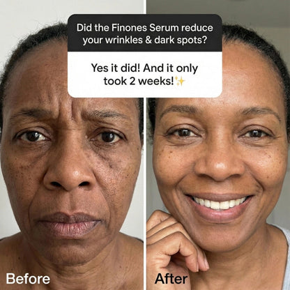 Vitanelle™ Skin Vitamin Serum