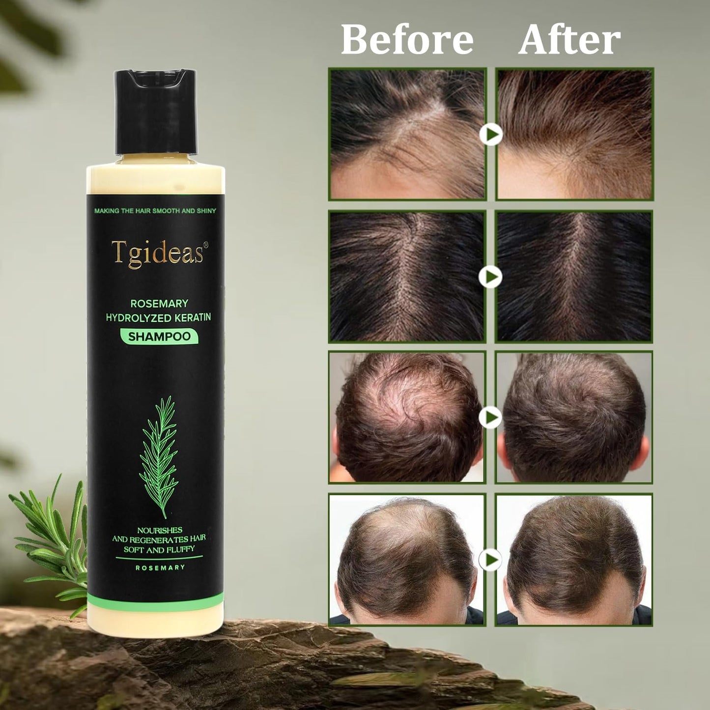 Tgideas Rosemary Hair Growth Shampoo