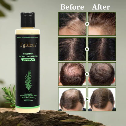 Tgideas Rosemary Hair Growth Shampoo