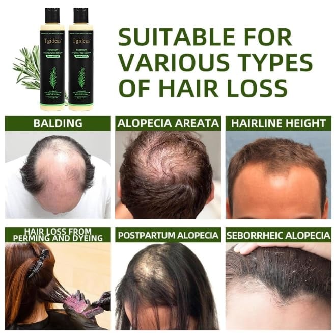 Tgideas Rosemary Hair Growth Shampoo