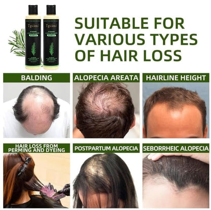 Tgideas Rosemary Hair Growth Shampoo